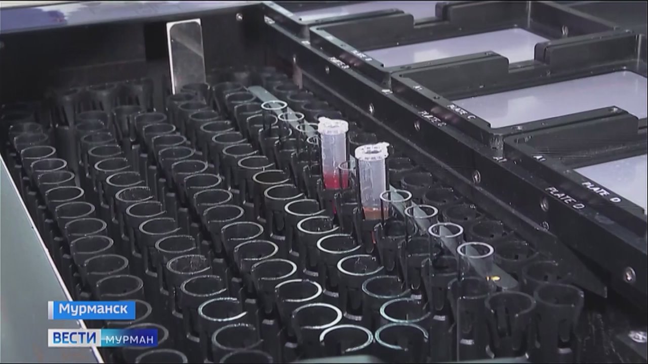 1 декабря во всем мире отмечается День борьбы со СПИДом