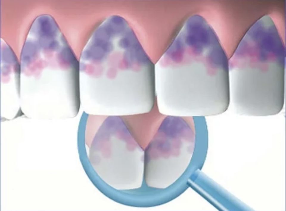 ��� ���������� ������� ����� �������� ������������ �������� ���