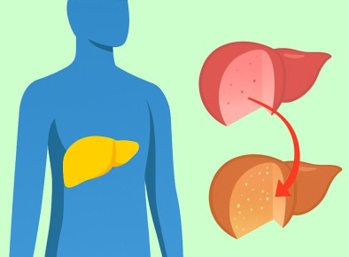 Как печень избавляется от жира без сложных диет