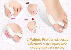 ��� ���������� �� �������� �� ����� � �������� ��������