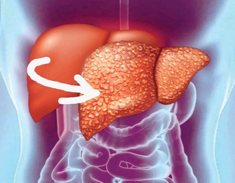 ��� �������� ������: ��� �������� ��� ���������� ����