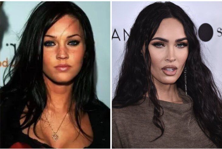 Увидеть себя свежей: как пластика меняет образ и ощущение уверенности